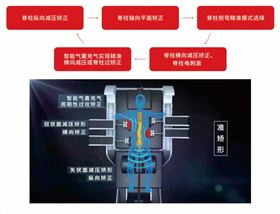 外星艙三維脊柱減壓矯形系統(tǒng)